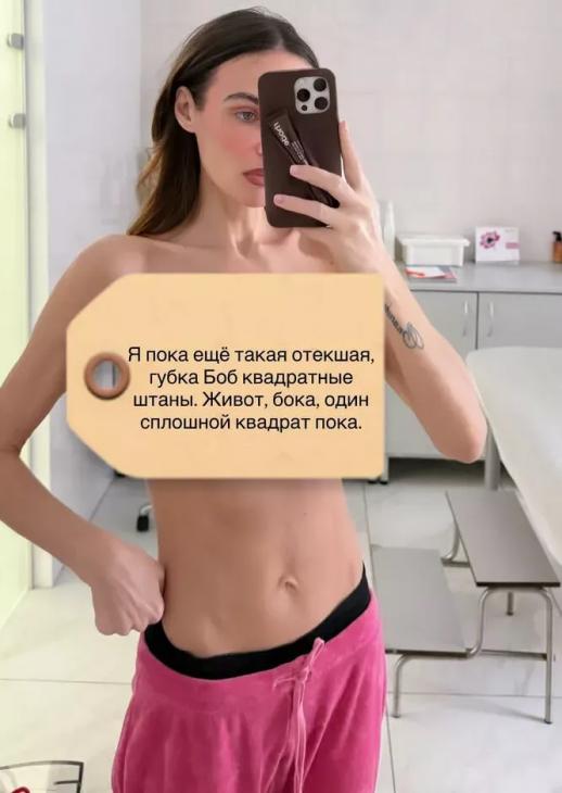 
                Алена Водонаева продемонстрировала фигуру после пластики: "Один сплошной квадрат"            