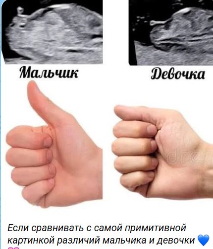Виктория Салибекова надеется родить дочку, но чувствует, что будет сын Виктория Салибекова надеется родить дочку, но чувствует, что будет сын