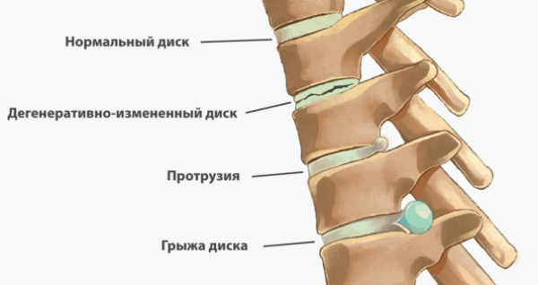 Обратная гиперэкстензия. Техника для ягодиц Обратная гиперэкстензия. Техника для ягодиц