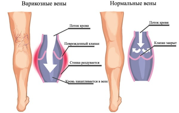 Становая тяга сумо. Техника, какие мышцы работают Становая тяга сумо. Техника, какие мышцы работают
