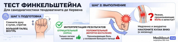 Синдром маминого запястья или теносиновит Де Кервена: почему болят руки при ношении младенца? Синдром маминого запястья или теносиновит Де Кервена: почему болят руки при ношении младенца?